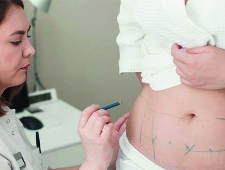 esthétique du ventre