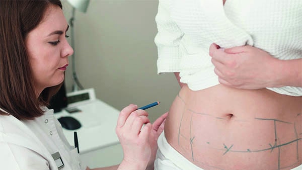 esthétique du ventre